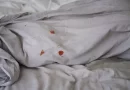 Bleeding During Sex